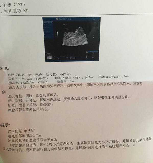 郑州捐卵仲介，郑州供卵试管婴儿费用（郑州捐卵子）